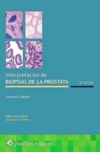 Interpretación de Biopsias de la Próstata