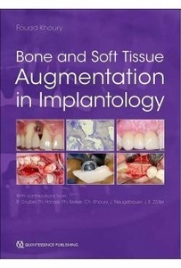 BONE AND SOFT TISSUE AUGMENTATION IN IMPLANTOLOGY