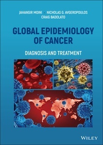 Global Epidemiology of Cancer "Diagnosis and Treatment"