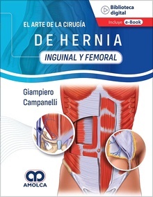 El Arte de la Cirugía de Hernia "Inguinal y Femoral"