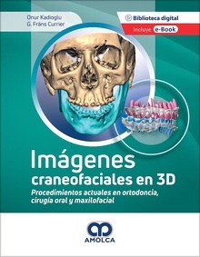 Imágenes Craneofaciales en 3D "Procedimientos Actuales en Ortodoncia, Cirugía Oral y Maxilofacial"