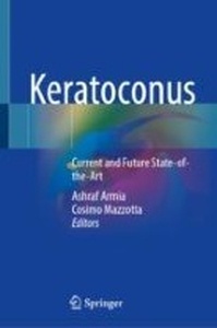 Keratoconus "Current and Future State-of-the-Art"