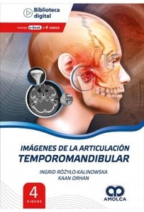 Imagenes de la Articulación Temporomandibular