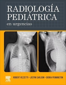 Radiología Pediátrica en Urgencias