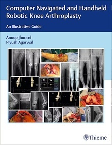 Computer Navigated and Handheld Robotic Knee Arthroplasty "An Illustrative Guide"