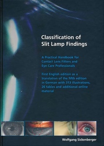Classification of Slit Lamp Findings "A Practical Handbook for Contact Lens Fitters and Eye Care Professionals"