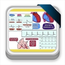 Curso Universitario Práctico para la Interpretación de Electrocardiogramas