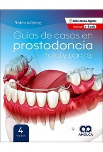 Guías de Casos en Prostodoncia Total y Parcial