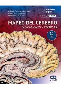 Mapeo del Cerebro "Indicaciones y Técnicas"
