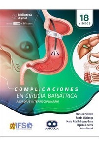 Complicaciones en Cirugía Bariátrica "Abordaje Interdisciplinario"