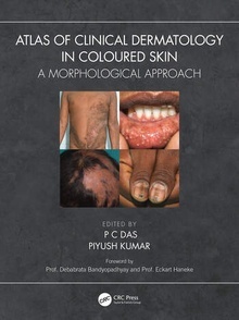 Atlas of Clinical Dermatology in Coloured Skin "A Morphological Approach"