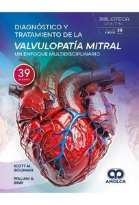 Diagnóstico y Tratamiento de la Valvulopatía Mitral "Un Enfoque Multidisciplinario"