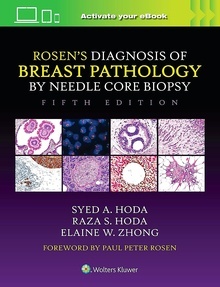 ROSEN's Diagnosis of Breast Pathology by Needle Core Biopsy