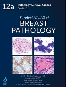 Survival Atlas to Breast Pathology "Pathology Survival Guides Series 1, Vol. 12a"