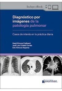 Diagnóstico por Imagenes de la Patología Pulmonar "Casos de Interés en la Práctica Diaria"