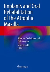 Implants and Oral Rehabilitation of the Atrophic Maxilla "Advanced Techniques and Technologies"