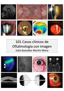 101 Casos clínicos en Oftalmología con imagen