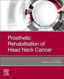 Prosthetic Rehabilitation of Head and Neck Cancer
